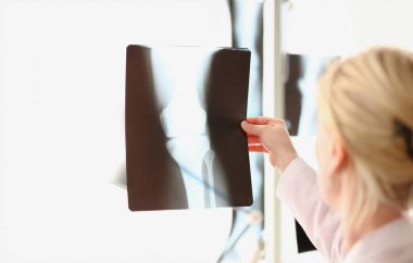 Doktor tedaviden önce diz ekleminin röntgenine bakıyor. Hastane konseptinin ortopedik bölümündeki kemik görüntüsü