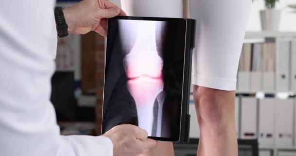 근처에 무릎의 엑스레이와 디지털 태블릿을 의사는 필름의 동작을 클로즈업한다 류머티즘 — 비디오