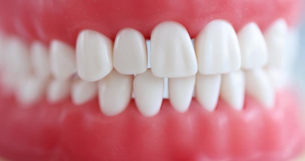 Künstlicher Kiefer Mit Schönen Geraden Zähnen Verbundfurniere Auf Zähnen Konzept — Stockvideo