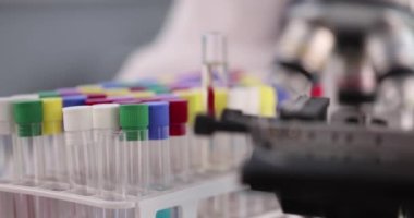 Bilimadamı teknisyen mikroskop altında kan örneğini inceler. FDA PCR transkripsiyon testi sonucu. Mikrobiyoloji laboratuvar teknisyeni koronavirüsü veya moleküler genetik konsepti test ediyor.