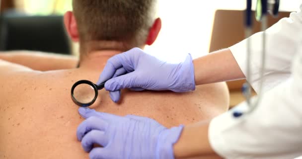 Médico Oncologista Examinando Nevos Pigmentados Paciente Com Lupa Closeup Filme — Vídeo de Stock