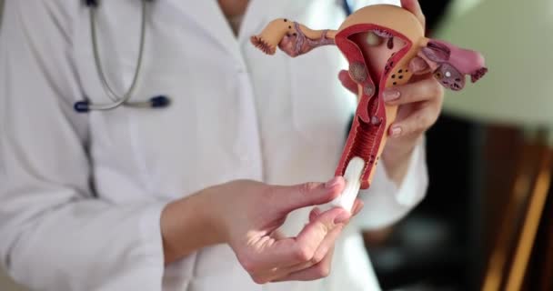 Doctor Gynecologist Inserting Tampon Vagina Artificial Model Uterus Ovaries Closeup — Vídeo de Stock