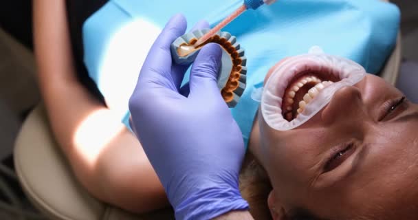 Kobieta Otwartymi Ustami Dentystą Zbliżeniem Przygotowanie Odlewu Wkładki Szczękowej — Wideo stockowe