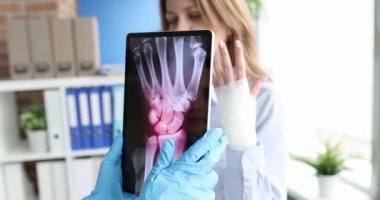 Doktor bilek ekleminde ağrısı olan hastanın elinin röntgeniyle tableti tutuyor. Bilek yaralanmaları el bağları kavramında burkulmalar ve yırtılmalar