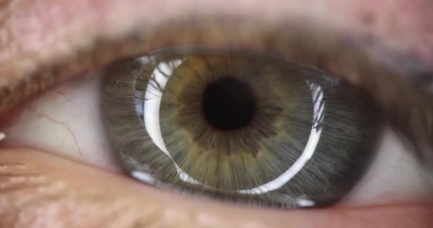 Серый Зеленый Глаз Концепция Лазерной Коррекции Зрения Проверки Зрения — стоковое видео