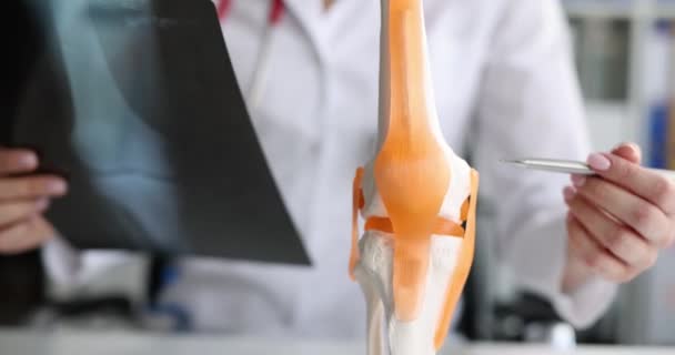 Arzt Mit Röntgenbild Des Kniegelenks Des Patienten Der Klinik Knieprobleme — Stockvideo