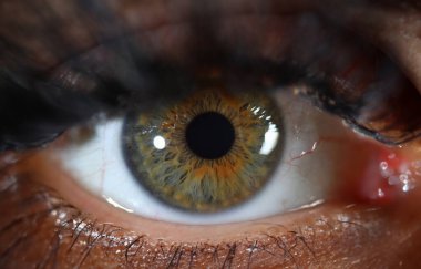 Gri yeşil göz ile insan gözü ayrıntıları. Göz hastalıkları ve lazer görüş düzeltme kavramı