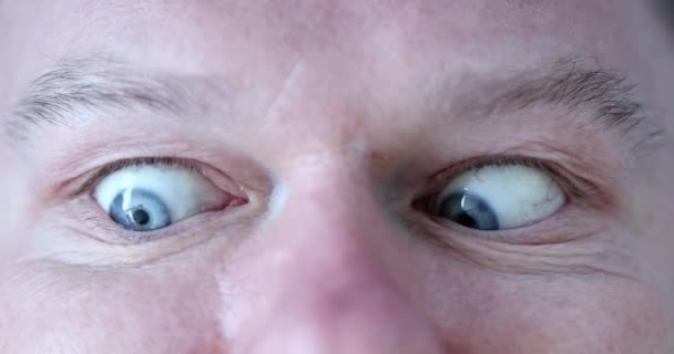 目のために運動する若者 私のユートピアで目を充電する — ストック動画