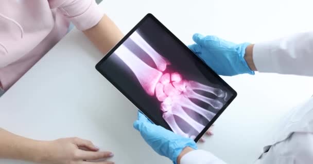 Inflamação Dos Ossos Das Mãos Raio Paciente Conceito Tretching Rasgar — Vídeo de Stock