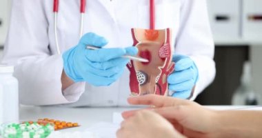 The doctor shows the anatomical model of the anus with hemorrhoids, close-up. Treatment with drugs at the proctologist