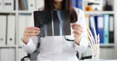 Kadın doktor bileğin röntgenini gösteriyor, yakın plan. Fraktür teşhisi, cerrahlar danışma, sağlık hizmetleri