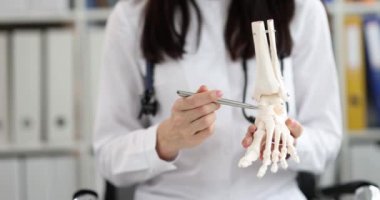 Doktor ayağın anatomik modelini gösteriyor, yakın plan. Fraktür teşhisi, ameliyat eğitimi, ilaç