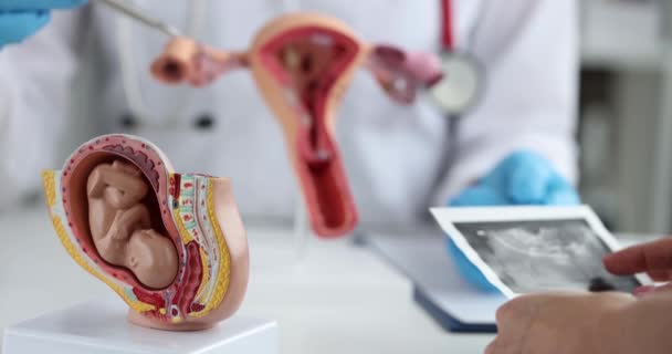 Der Arzt Zeigt Das Anatomische Modell Der Gebärmutter Mit Dem — Stockvideo