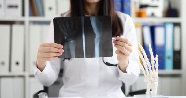 Kvinna Läkare Visar Röntgen Handleden Närbild Frakturdiagnos Konsultation Kirurger Hälso — Stockvideo