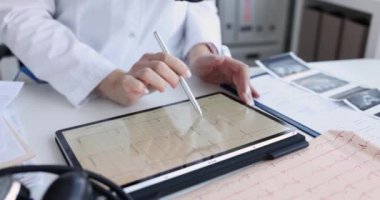 Doktor tabletin ekranındaki kardiyogramı inceliyor, yakın plan. Elektrokardiyogram, klinik çalışma