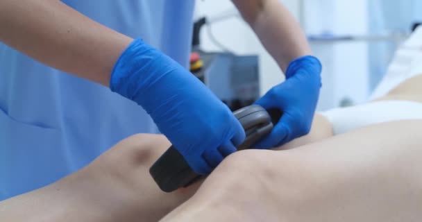 Médico Remove Vascular Nas Pernas Uma Mulher Com Laser Close — Vídeo de Stock
