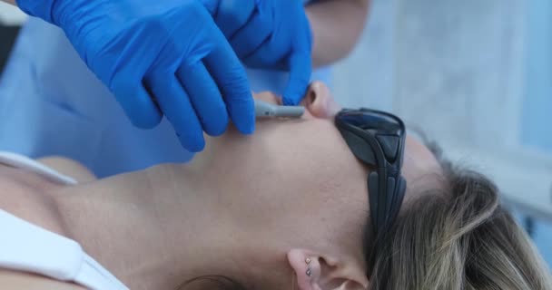 Esteticista Remove Cabelo Sobre Lábio Das Mulheres Close Laser Epilation — Vídeo de Stock