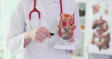 The doctor holds a magnifier and anatomical model of the anus. Search for hemorrhoids, conceptual medicine