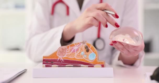Läkaren Håller Implantatet Det Kvinnliga Bröstet Närbild Mammoplastik Bevarande Bröstkörteln — Stockvideo