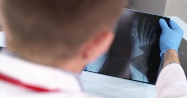 Doktor travmatolog, arka plandaki ayak röntgenine bakıyor. Hasta yaralı bacak 4K film ağır çekim. Fraktür tanısı ve tedavi kavramı