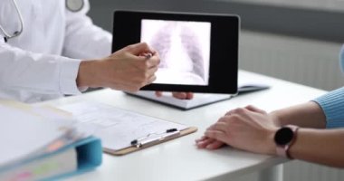 Doktor, dijital tablet 4K filmdeki hastaya akciğerlerinin röntgenini gösteriyor. Zatürree teşhisi ve tedavisi