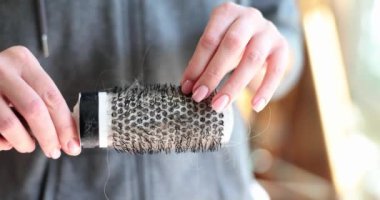 Kadın elinde tarakla saçlarını kaybediyor. Dişi kellik ve tedavi