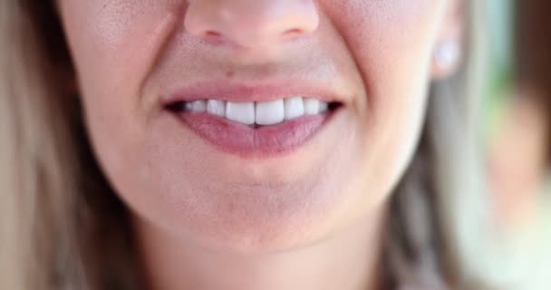 Mükemmel Dişleri Porselen Kaplamaları Olan Gülen Bir Kadın Diş Beyazlatma — Stok video