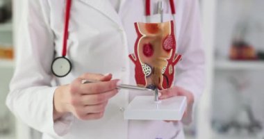 Rektum, hemoroit ve kabızlık hastalıklarının tedavisi. Proktolog anatomik model rektumunun patolojisine işaret ediyor
