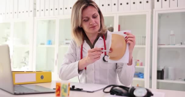 성형외과 전문의는 유방의 해부학 구조를 보유하고 진료소 에서의 유방암 — 비디오