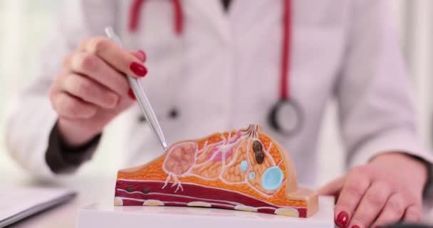 Nőgyógyász Elmagyarázza Női Mellbetegségeket Klinikán Emlőrák Tünetei Diagnózisa — Stock videók