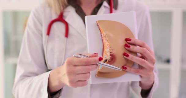 Arts Toont Verklaart Borstziekte Gebruikend Anatomisch Model Van Borst Symptomen — Stockvideo