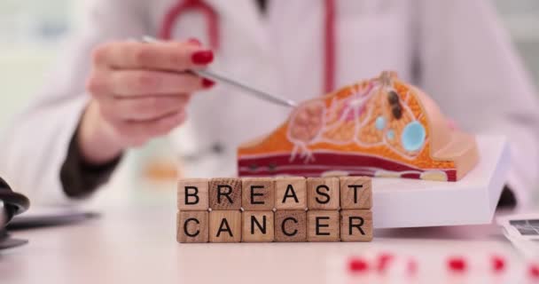 乳腺医生手中的乳腺癌模型解剖征象 乳腺癌治疗和肿瘤学家 — 图库视频影像