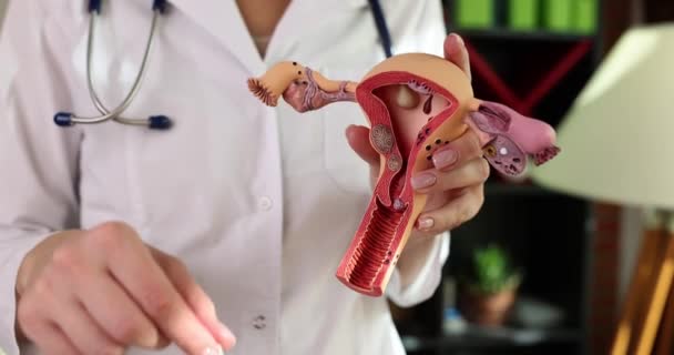 婦人科医の手は子宮とタンポンの閉鎖のモデルを保持しています 女性の衛生と婦人科 — ストック動画