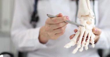 Ortopedi doktoru ayak bileğindeki iskelete bakıyor. Yerleşim bozuklukları, tedavi ve düz taban kavramı