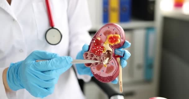 Surgery Kidneys Adrenal Glands Medical Surgical Intervention Doctor Holds Kidney — Stock Video