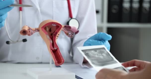 Гінеколог Консультує Жінку Ультразвуковим Скануванням Матки Клініці Гінекологічні Захворювання Концепції — стокове відео