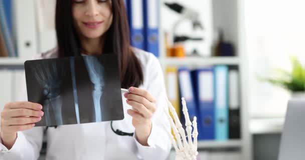 Lekarz Trzyma Rękach Prześwietlenie Dłoni Model Szkieletu Dłoni Opieka Medyczna — Wideo stockowe