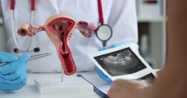 Gynekolog Visar Modell Kvinnliga Reproduktiva Systemet Till Ung Kvinna Kliniken — Stockvideo