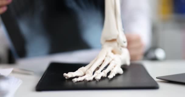 Trauma Surgeon Evaluates Rays Legs Skeletal Foot Symptoms Treatment Concept — Stockvideo