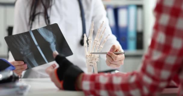 Ортопед Показывает Рентгеновскую Анатомию Кисти Пациента Клинике Концепция Повреждения Рук — стоковое видео