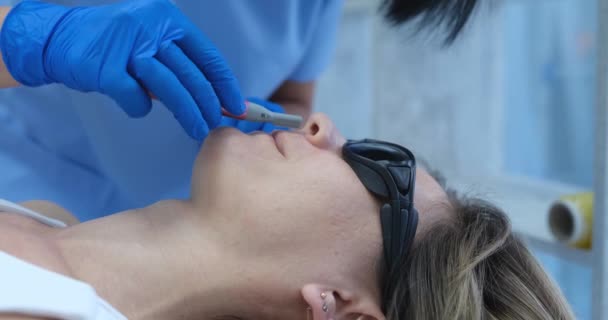 Hårborttagning Ovanför Överläppen Kosmetolog Epilering Ansiktshår Koncept — Stockvideo