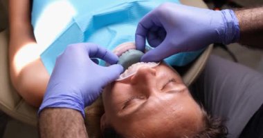 Dentist tries on dental sample for installing veneer. Preparation of teeth for veneers