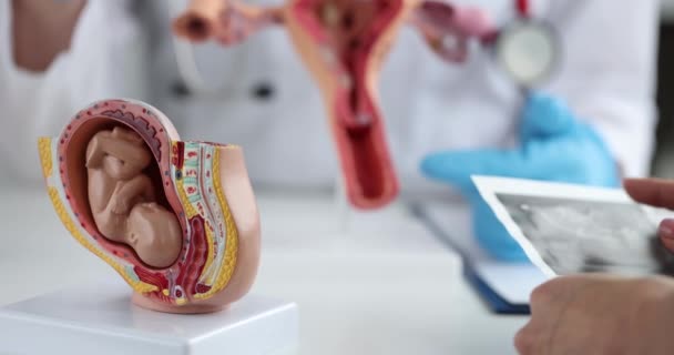 Model Embryo Ultrasound Uterus Examination Pregnant Woman Ivf — Stock Video