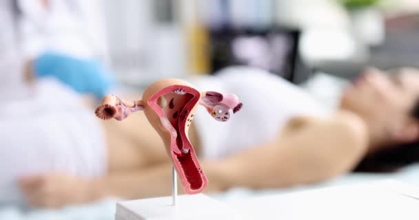 Kadın Rahim Sağlığı Jinekoloji Muayenesi Rahim Ağzı Hastalıklarının Tedavisi Teşhisi — Stok video