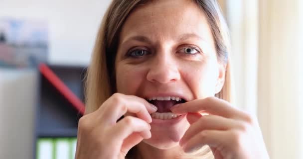 Жінка Вставляє Пластикову Ковпачок Вирівнювання Укусу Зубів Шапки Виправлення Укусу — стокове відео