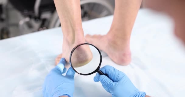 Dermatólogo Lleva Cabo Examen Físico Piel Las Piernas Través Lupa — Vídeos de Stock
