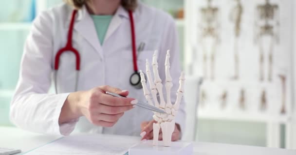 解剖学モデル上のヒトの手の構造を示す医師リウマチ学は 4K映画のスローモーションを閉じます 関節の関節リウマチ性疾患の病理概念 — ストック動画