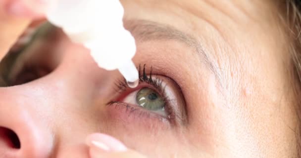 瓶子里的水滴正在滴落到女人干瘪的眼睛里 结膜炎治疗概念与视力问题 — 图库视频影像