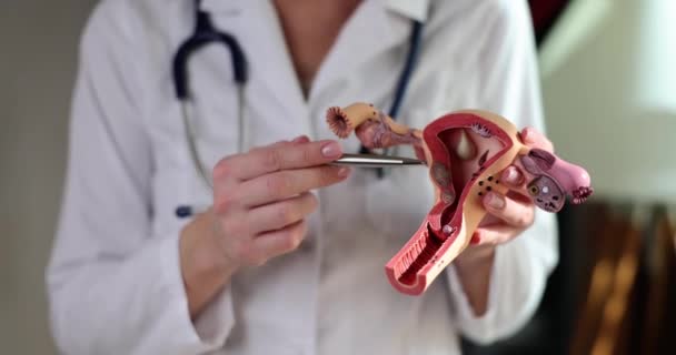 Gynäkologe Zeigt Nahaufnahme Auf Plastikmodell Von Gebärmutter Und Eierstöcken Krankheit — Stockvideo