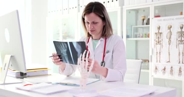 Ακτινογραφία Του Χεριού Στα Χέρια Του Γιατρού Ανατομία Των Χεριών — Αρχείο Βίντεο